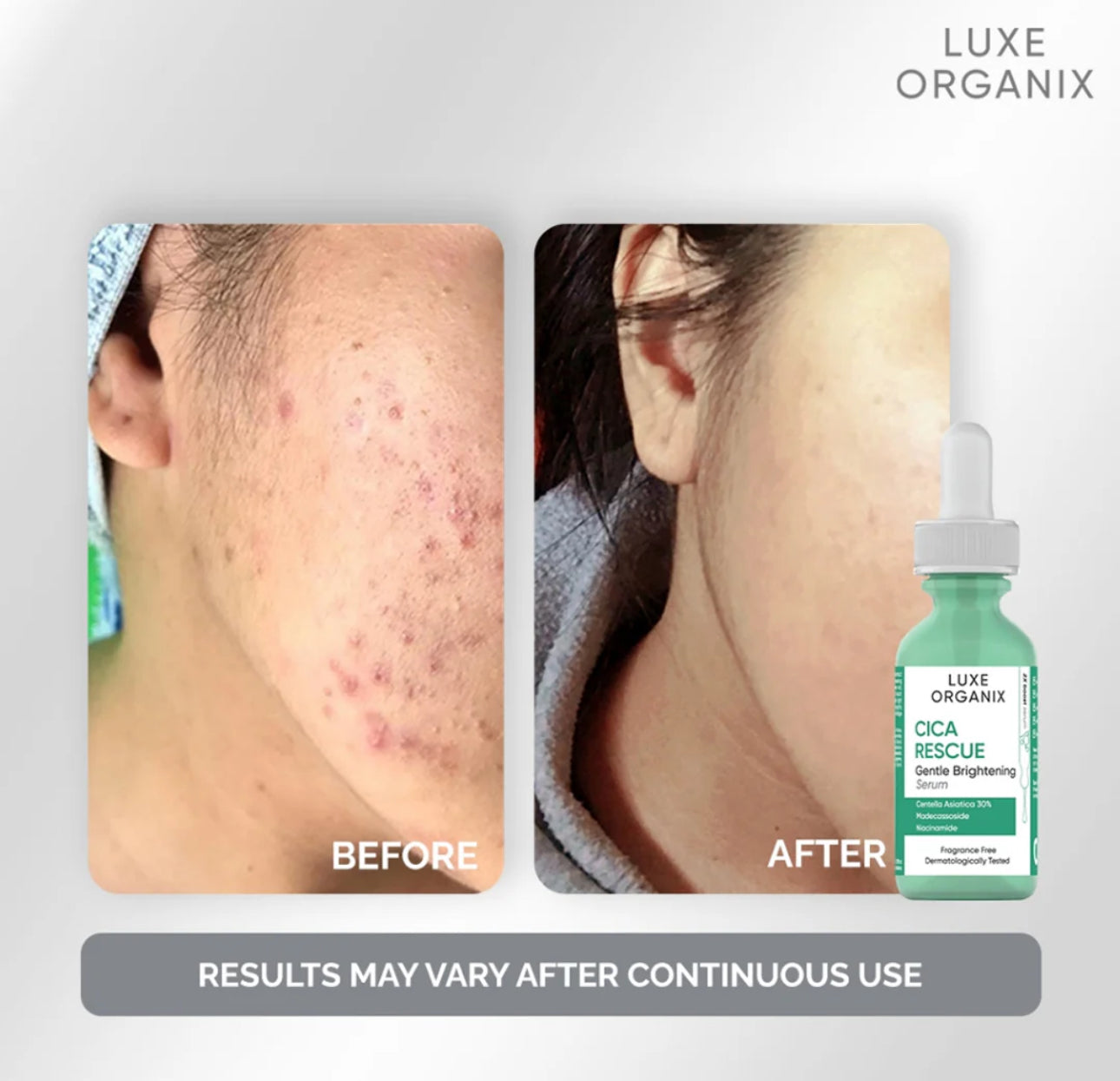 Luxe Organix Cica Rescue Gentle Brightening Bundle