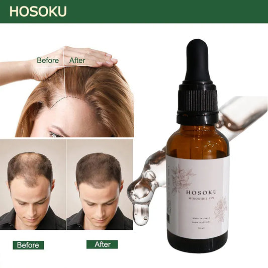🥰HOSOKU MINOXIDIL with Castor Oil – Ultra Strength Hair Regrowth Oil (30ml)